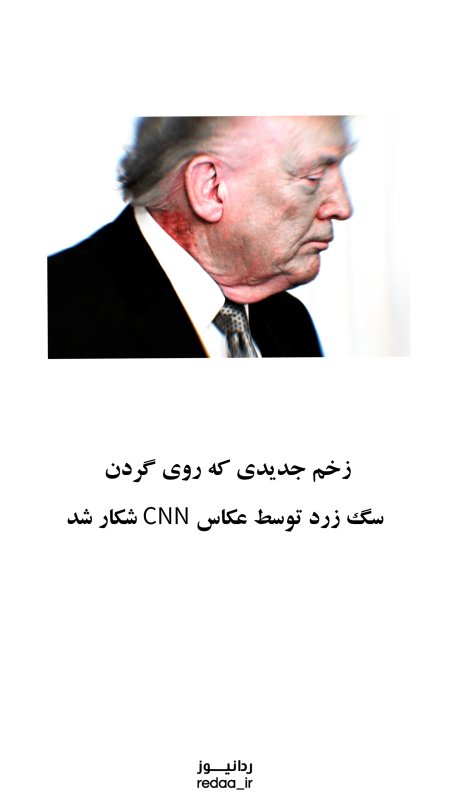 زخمی روی گردن شیطان بزرگ
